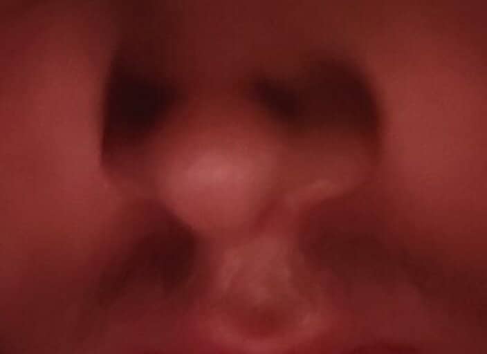 Louis64