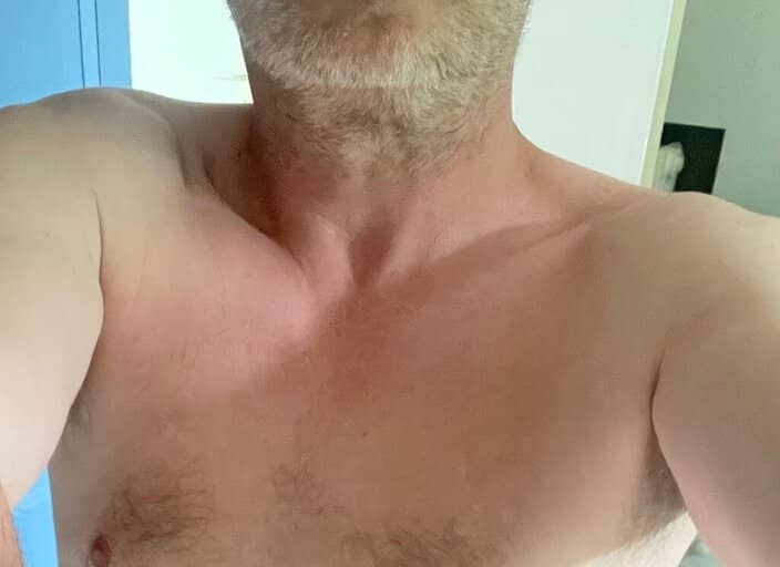 MI1753398