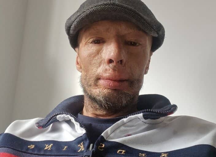Toto28