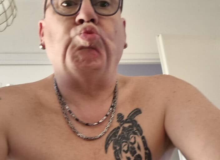 Patis31p