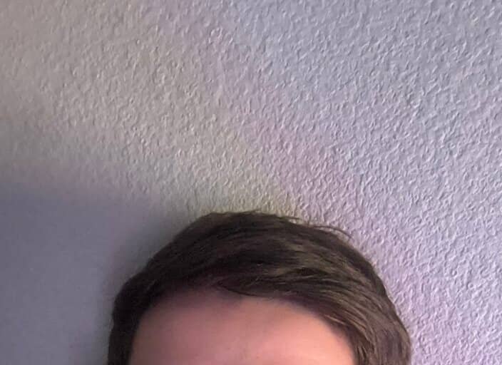 yoy0