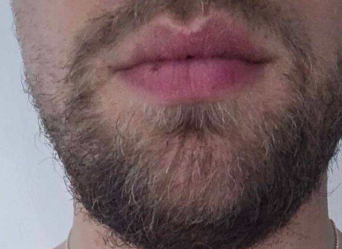lecoquin5