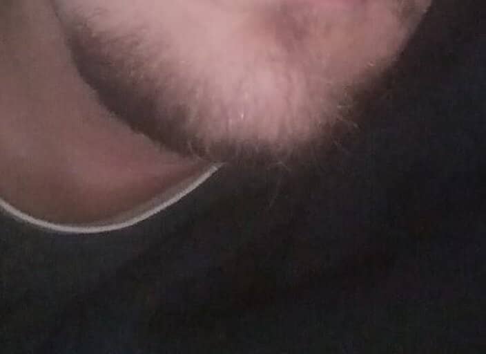 Hugo__f