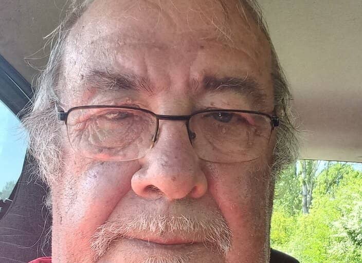 patrick79
