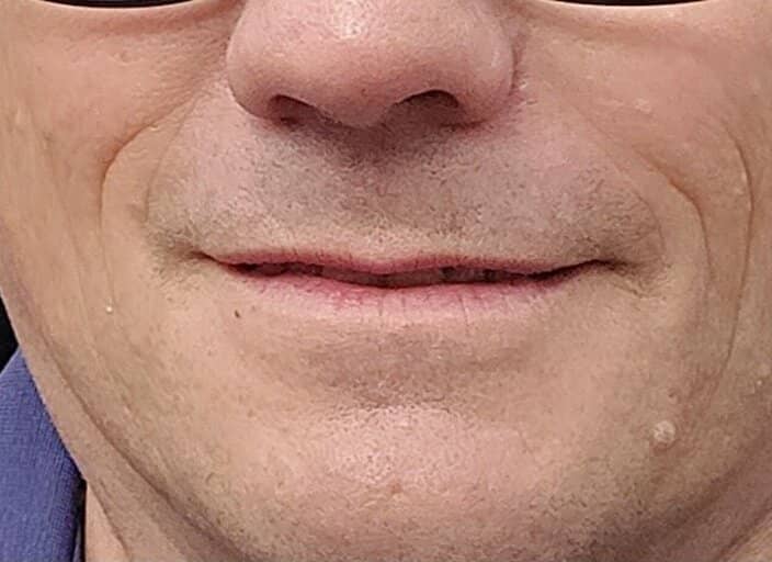 modop72