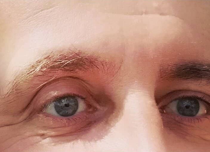 Fetichecollant