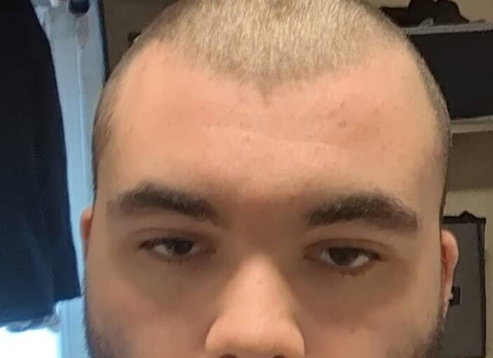 RKT