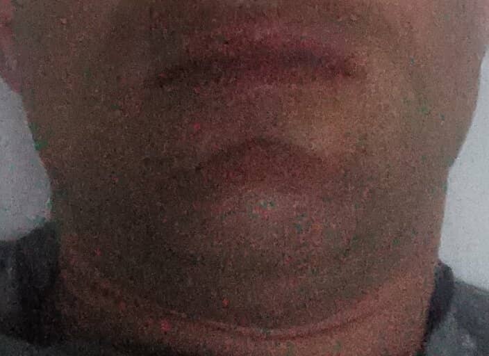 edeludo