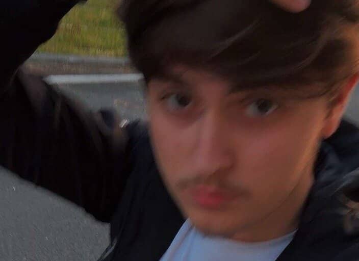 Anzorbdx