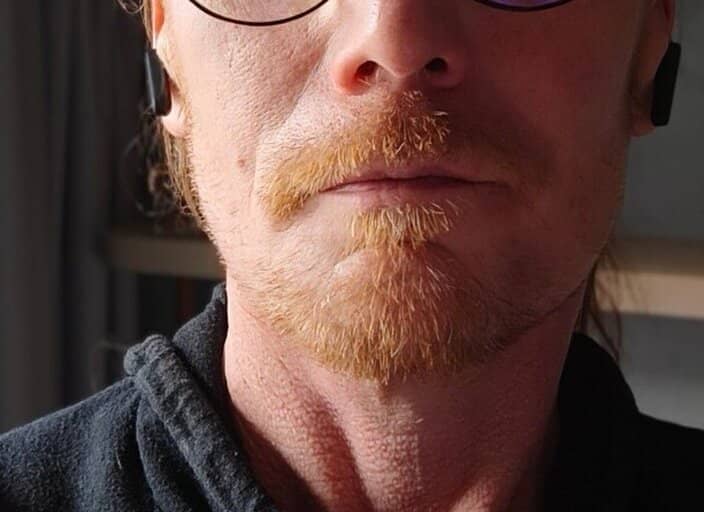 Foxdu76