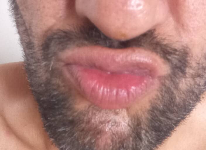 hanniboule