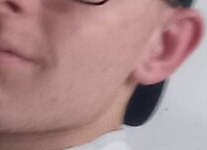 Corentin62200
