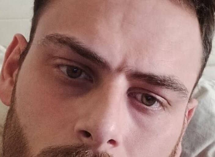 blya