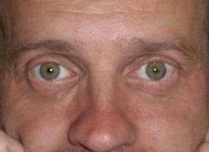 ericcoco