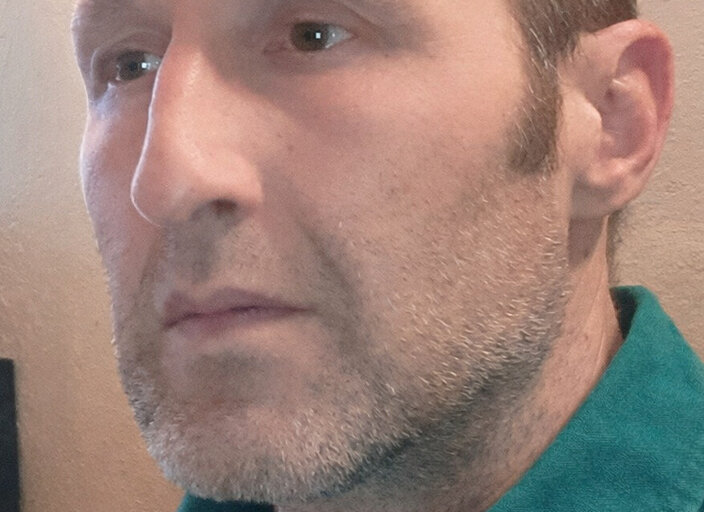 yannoso