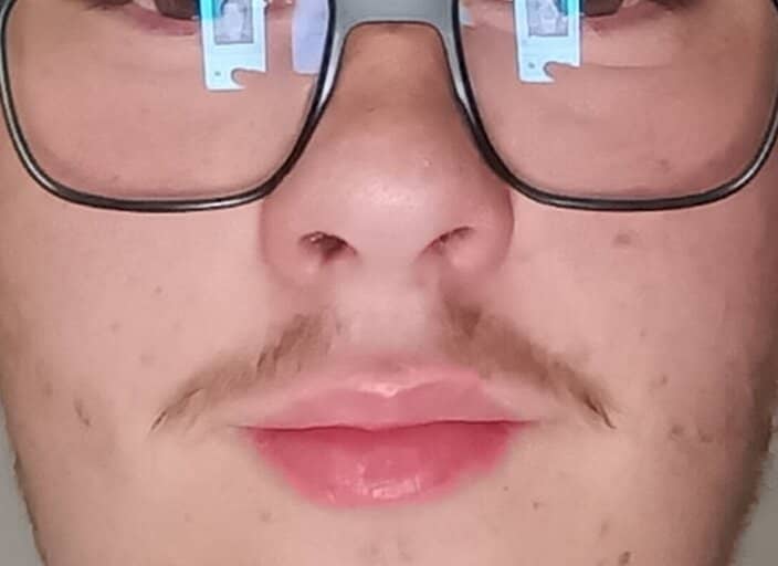 Mathys1