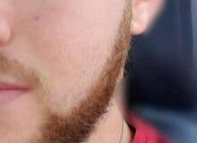 Photo de 000Antoine000