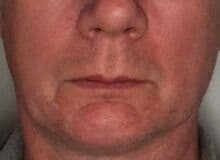 Photo de Johanverwennen