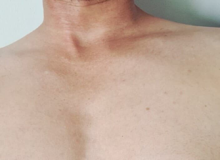 Jlv