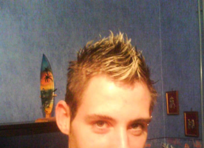 skin87