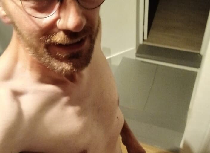 MI1629522