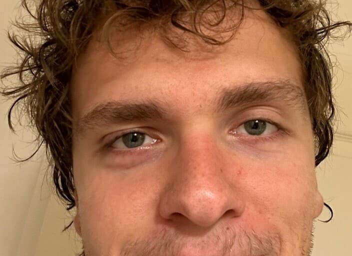 add11