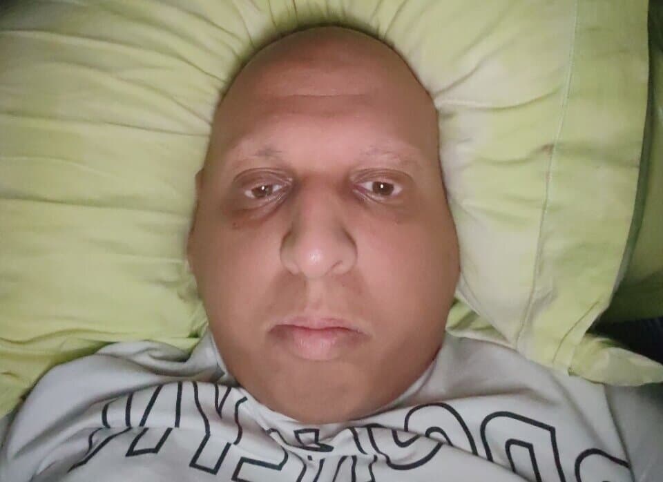 tgc377