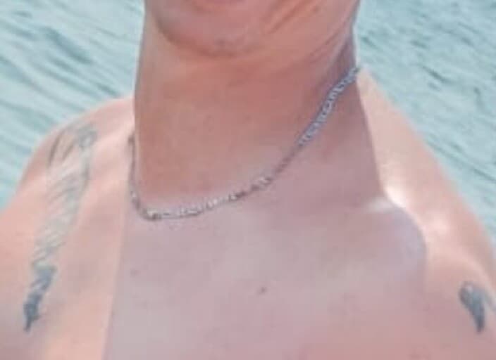 Klaim