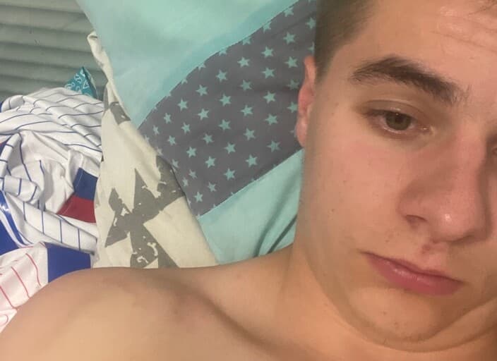 oeponveraa
