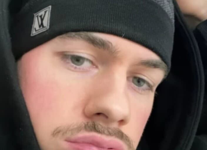 ElMacho7