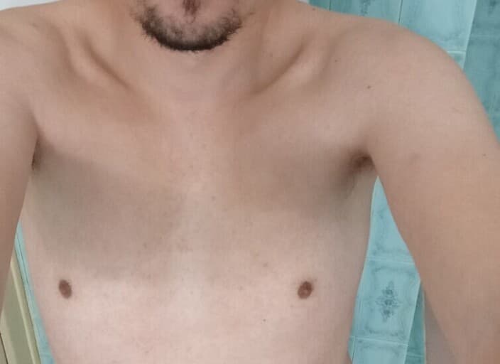 MI1611404