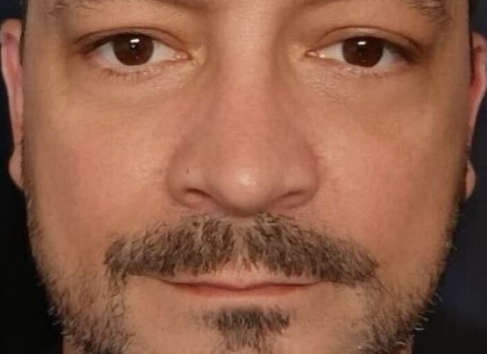 neodam