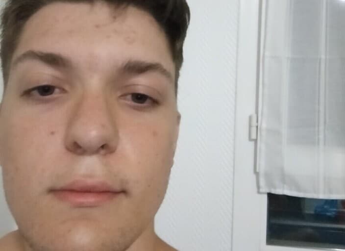 Alexisdus