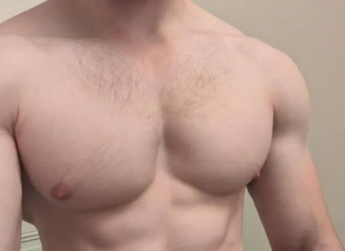 muscleparis