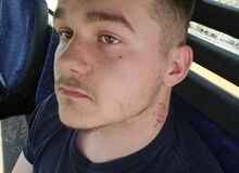 Tyson